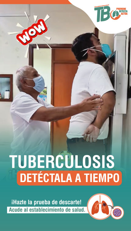 Detección de Tuberculosis