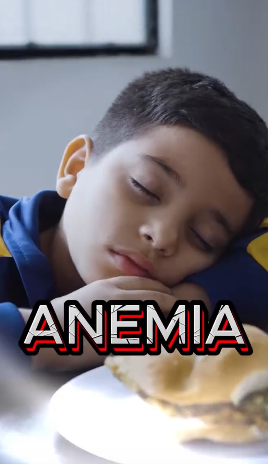 ANEMIA